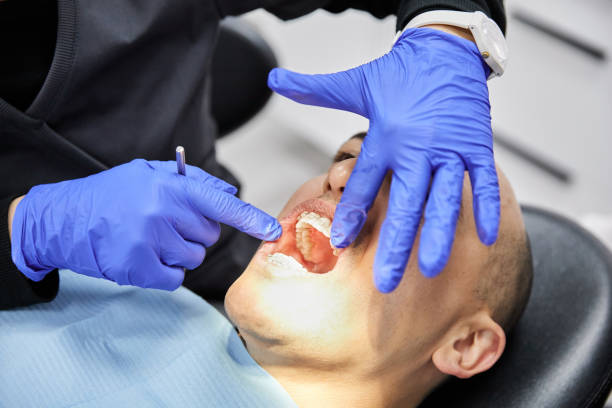 Best Broken or Chipped Tooth Repair in Carnot Moon, PA